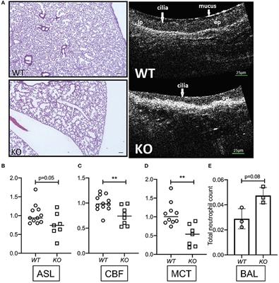 The Effects of the Anti-aging Protein Klotho on Mucociliary Clearance
